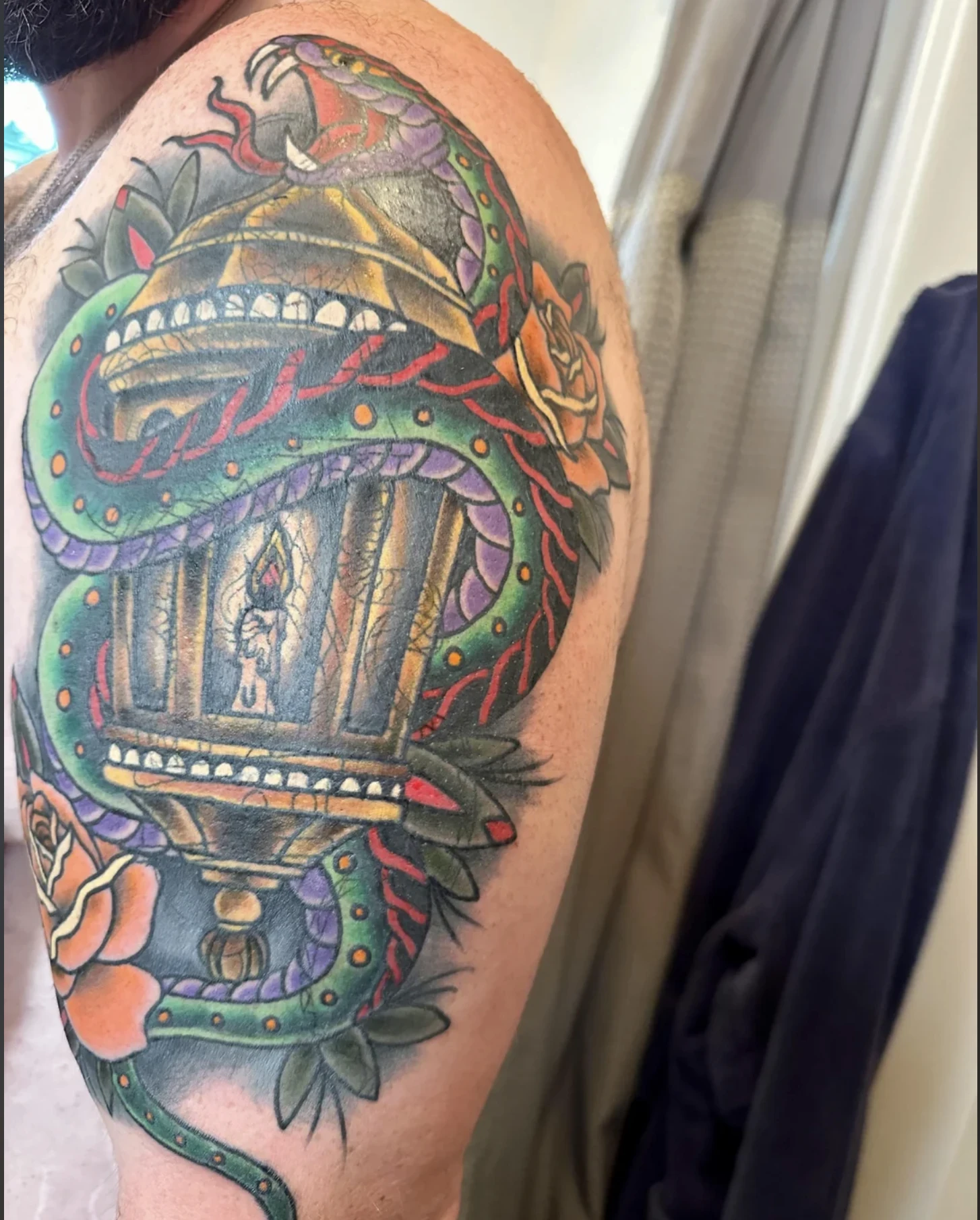 Complete tattoo removal achieved on a heavily scarred tattoo after multiple sessions