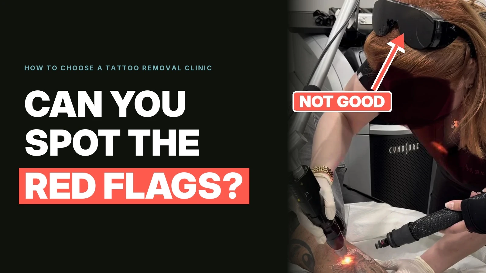 How to Choose a Tattoo Removal Clinic: Questions & Red Flags